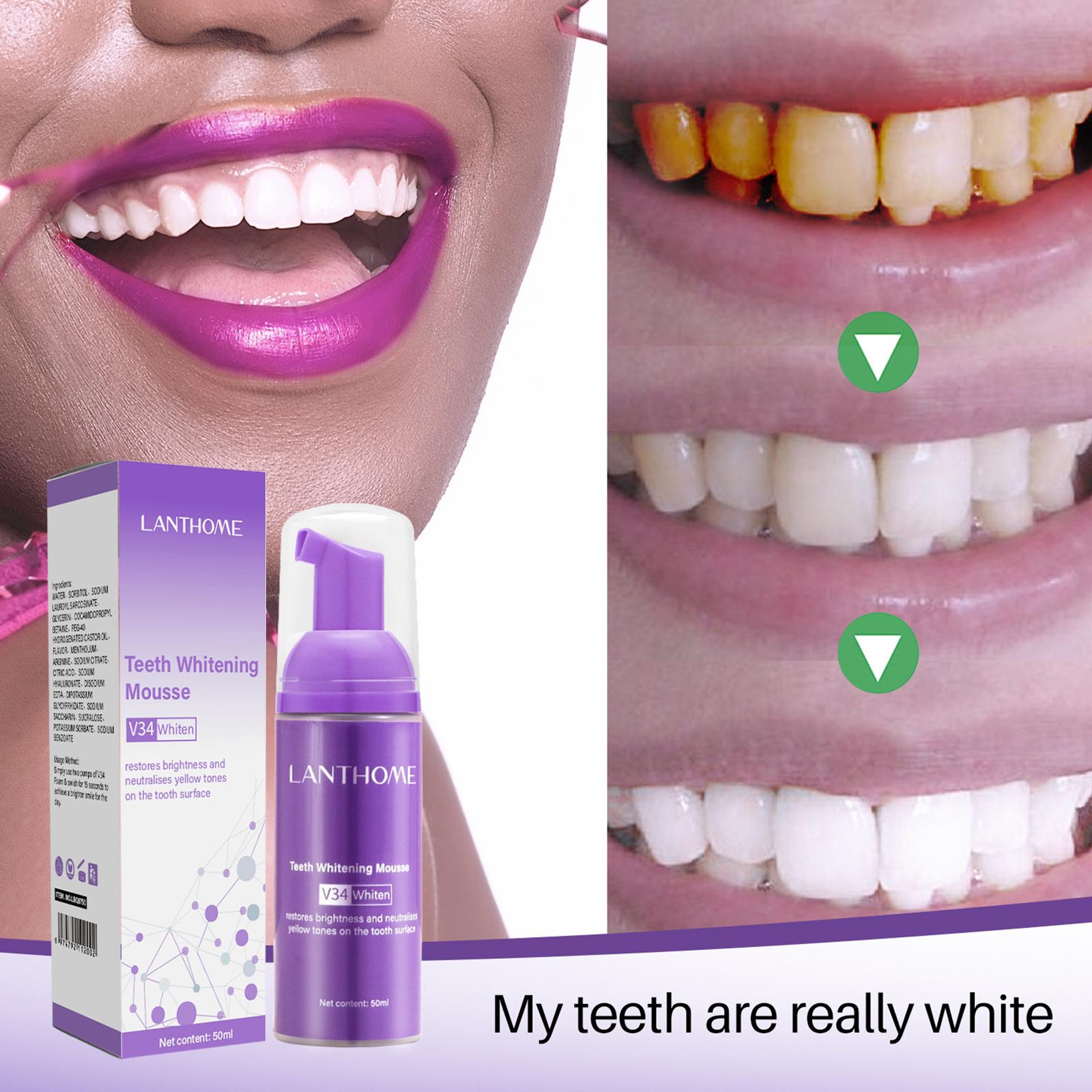 50MLTeeth ホワイトニングムース汚れを除去新鮮な息歯 - Teeth Whitening Foam Toothpaste のレビューと価格