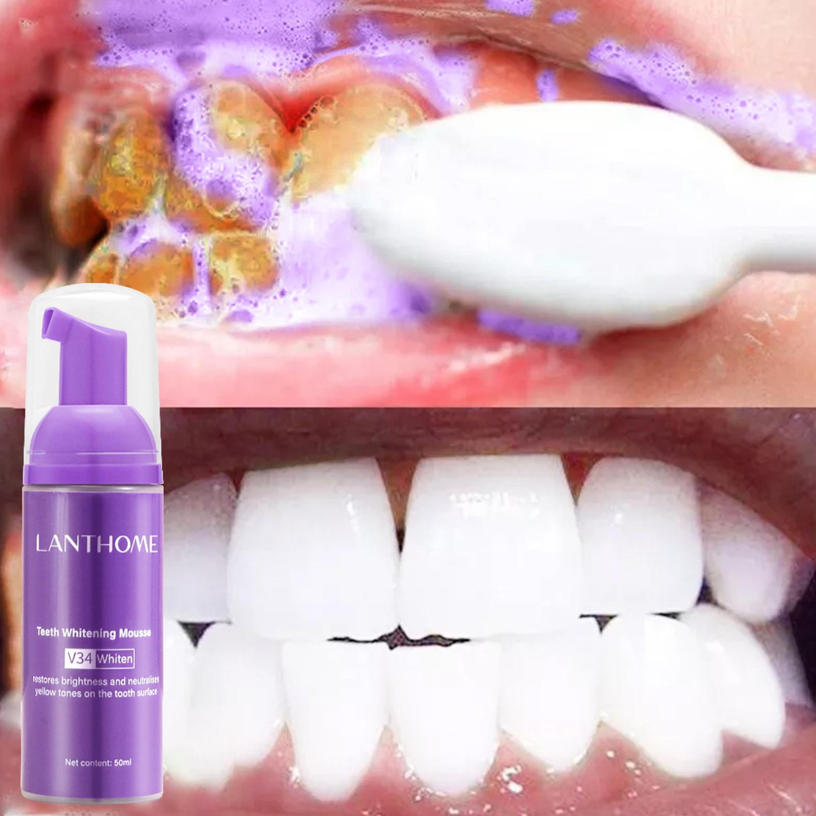 50MLTeeth ホワイトニングムース汚れを除去新鮮な息歯 - Teeth Whitening Foam Toothpaste のレビューと価格