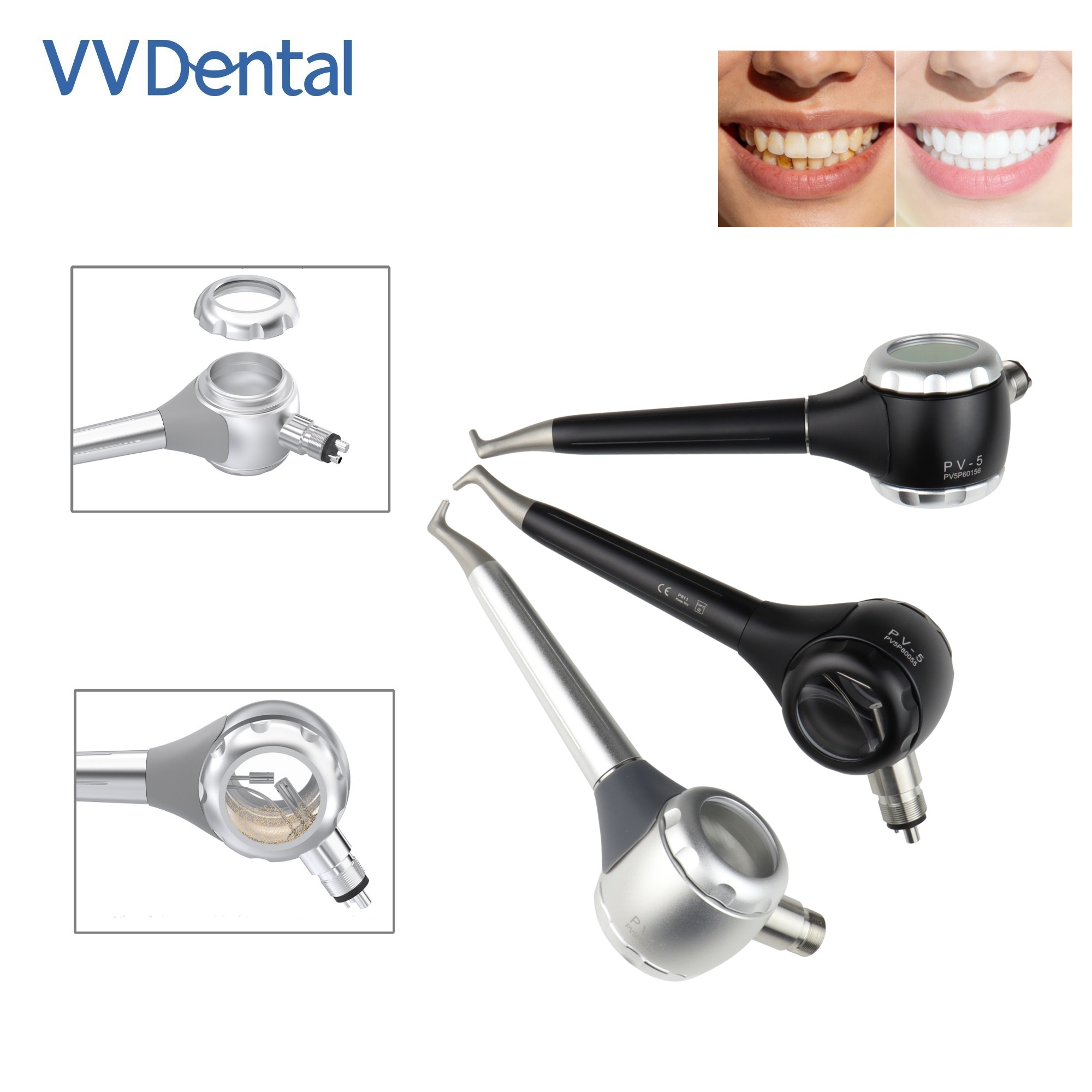 VV デンタル 2/4 穴歯ホワイトニングサンドブラストガン - Teeth Whitening Usa のレビューと価格