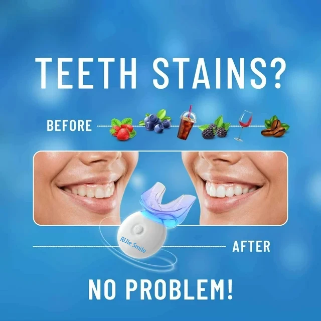高品質クリーニングキット ワイヤレスホワイトニングデバイス  - Teeth Whitening At Home Kit のレビューと価格