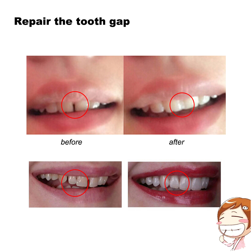 10/100g DIY義歯歯茎接着剤 手作りソリッドキャビテ - Teeth Whitening Diy のレビューと価格