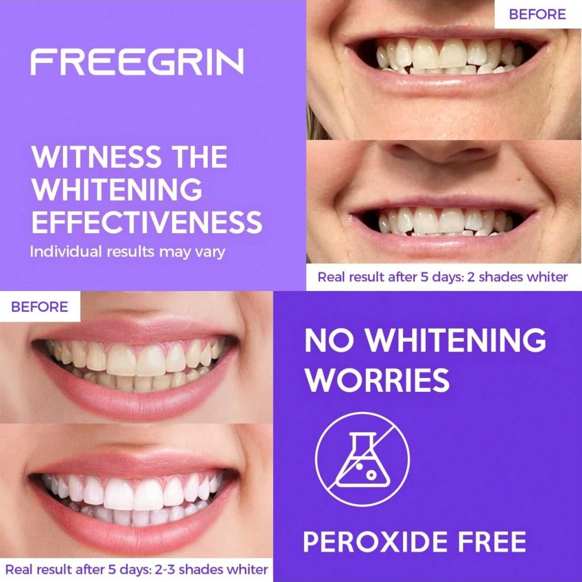 デラックスホワイトニング歯ステッカー 7/14/21 ペアジ - Teeth Whitening Near Me のレビューと価格